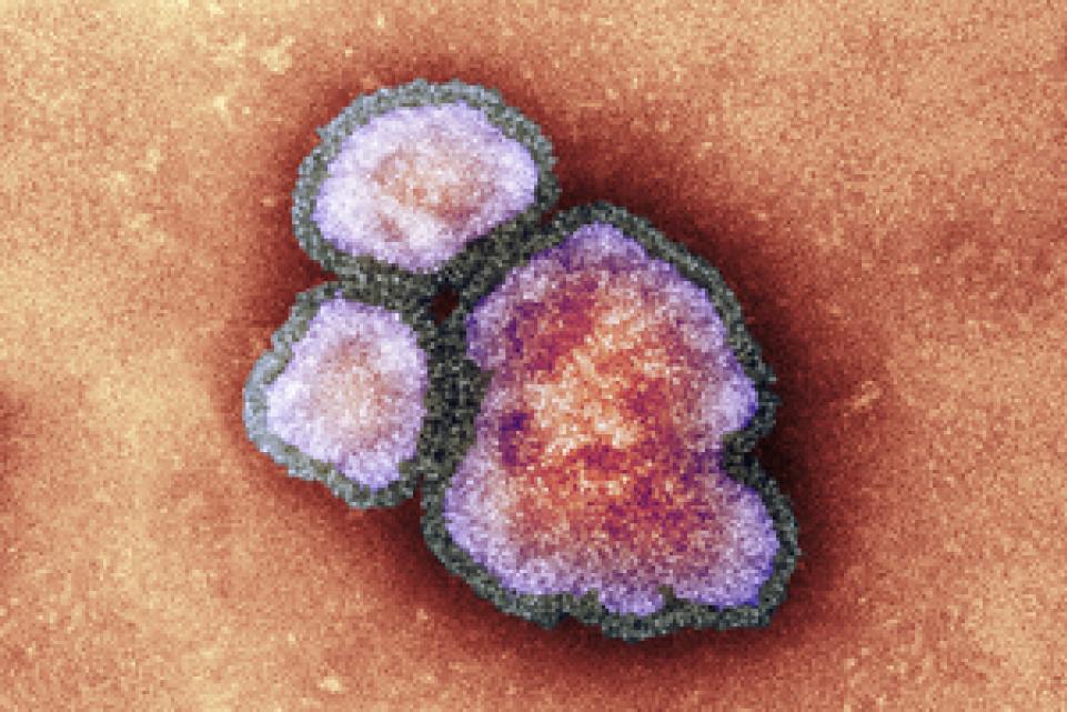 the virus measles